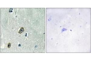 Immunohistochemistry analysis of paraffin-embedded human brain tissue, using KCIP1 Antibody. (14-3-3 zeta antibody  (AA 1-50))