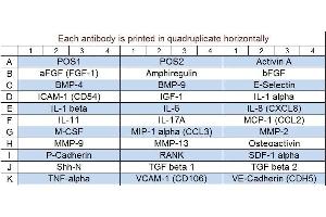 Image no. 1 for Human Bone Metabolism Array Q1 (ABIN4956024) (Human Bone Metabolism Array Q1)