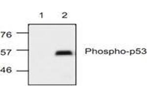 Image no. 1 for anti-Tumor Protein P53 (TP53) (pSer15) antibody (ABIN127171) (p53 antibody  (pSer15))