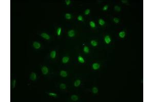 Immunofluorescence staining of A549 cells with ABIN7127721 at 1:100,counter-stained with DAPI. (Recombinant NFKBIA antibody  (pSer32))