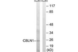 Western Blotting (WB) image for anti-Cerebellin 1 Precursor (CBLN1) (AA 131-180) antibody (ABIN2890205) (CBLN1 antibody  (AA 131-180))