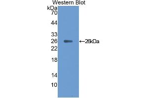 Western blot analysis of the recombinant protein. (CNTF antibody  (AA 2-200))