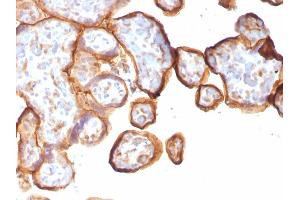 Immunohistochemistry (IHC) image for anti-Thrombomodulin (THBD) (AA 69-194) antibody (ABIN6940729)