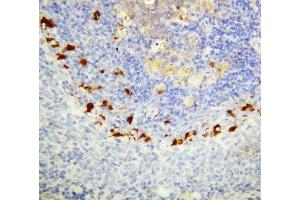 IHC-P: SOCS1 antibody testing of rat spleen tissue (SOCS1 antibody  (C-Term))