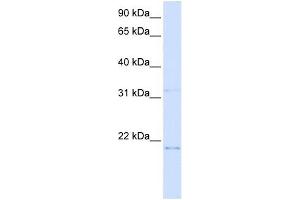 C14ORF180 antibody used at 1 ug/ml to detect target protein. (C14orf180 antibody  (N-Term))