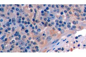 Detection of FAS in Human Tonsil Tissue using Polyclonal Antibody to Factor Related Apoptosis (FAS) (FAS antibody  (AA 22-172))
