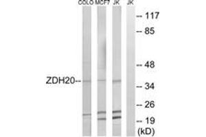 Western blot analysis of extracts from Jurkat/MCF-7/COLO cells, using ZDHHC20 Antibody. (ZDHHC20 antibody  (AA 72-121))