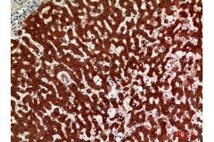 Immunohistochemical analysis of paraffin-embedded human-liver, antibody was diluted at 1:100. (HSD11B1 antibody  (N-Term))