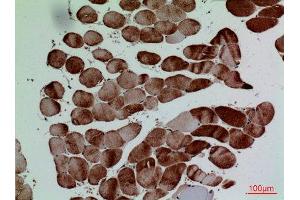 Immunohistochemistry (IHC) analysis of paraffin-embedded Human Muscle, antibody was diluted at 1:100. (CD7 antibody  (Internal Region))