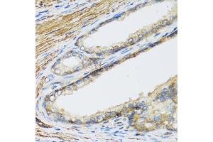 Immunohistochemistry of paraffin-embedded human prostate using CSH1 antibody. (CSH1 antibody)