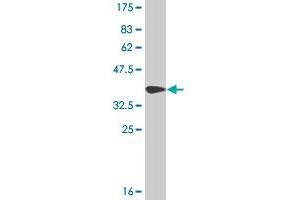 Western Blot detection against Immunogen (36. (SETDB2 antibody  (AA 451-550))