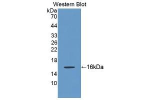 Figure. (Keratin 2 antibody  (AA 508-685))