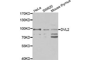 Western blot analysis of extracts of various cell lines, using DVL2 antibody. (DVL2 antibody)