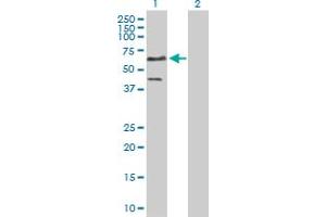 Lane 1: ETS1 transfected lysate ( 50. (ETS1 293T Cell Transient Overexpression Lysate(Denatured))