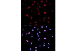 Immunofluorescence (IF) image for anti-Mitogen-Activated Protein Kinase Kinase 6 (MAP2K6) (pSer207) antibody (ABIN1870360) (MAP2K6 antibody  (pSer207))