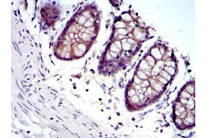 Immunohistochemistry (IHC) image for anti-Junction Plakoglobin (JUP) antibody (ABIN969225)