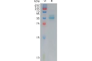 Angiotensin II Type-1 Receptor Protein (AA 1-27) (Fc Tag)