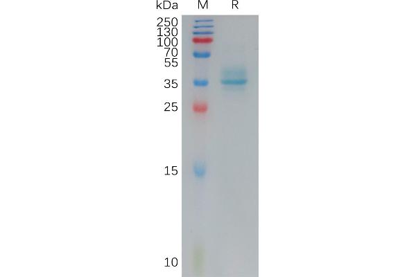 Angiotensin II Type-1 Receptor Protein (AA 1-27) (Fc Tag)