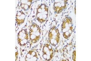 Immunohistochemistry of paraffin-embedded human colon using ERLIN1 antibody (ABIN7267005) at dilution of 1:100 (40x lens). (ERLIN1 antibody  (AA 259-348))