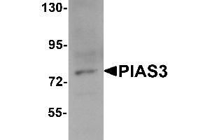 Western Blotting (WB) image for anti-Protein Inhibitor of Activated STAT, 3 (PIAS3) (C-Term) antibody (ABIN1030584) (PIAS3 antibody  (C-Term))