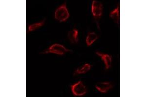 ABIN6267275 staining 293 by IF/ICC. (Estrogen Receptor alpha antibody  (pTyr537))
