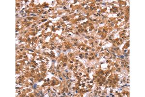 Immunohistochemistry (IHC) image for anti-APC Membrane Recruitment Protein 1 (AMER1) antibody (ABIN2433015) (WTX antibody)