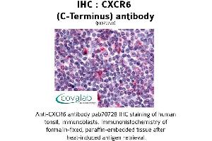 Image no. 1 for anti-Chemokine (C-X-C Motif) Receptor 6 (CXCR6) (C-Term) antibody (ABIN1733416) (CXCR6 antibody  (C-Term))