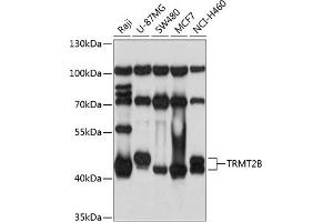 Western blot analysis of extracts of various cell lines, using TRMT2B antibody  at 1:1000 dilution. (TRMT2B antibody  (AA 1-250))