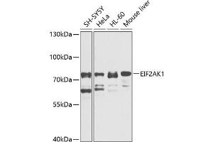 Western blot analysis of extracts of various cell lines, using EIF2 antibody  at 1:1000 dilution. (EIF2AK1 antibody  (AA 371-630))