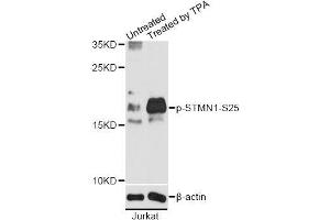 Western blot analysis of extracts of Jurkat cells, using Phospho-STMN1-S25 antibody (ABIN2987641) at 1/2000 dilution. (Stathmin 1 antibody  (pSer25))