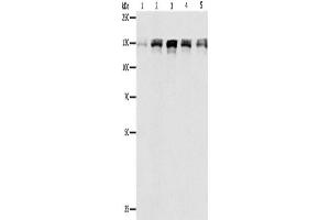 Western Blotting (WB) image for anti-Damage Specific DNA Binding Protein 1 (DDB1) antibody (ABIN2425764) (DDB1 antibody)