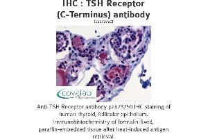 Image no. 1 for anti-Thyroid Stimulating Hormone Receptor (TSHR) (C-Term) antibody (ABIN1740417) (TSH receptor antibody  (C-Term))