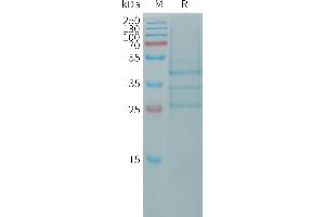 Human Protein, hFc Tag on SDS-PAGE under reducing condition. (BMP2 Protein (AA 283-396) (Fc Tag))