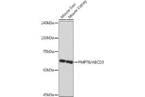 Western blot analysis of extracts of various cell lines, using PMP70/ Rabbit mAb (ABIN1683181, ABIN3018647, ABIN3018648 and ABIN7101638) at 1:1000 dilution. (CX3CL1 antibody)