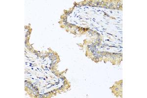 Immunohistochemistry of paraffin-embedded human prostate using DEFB121 antibody. (DEFB121 antibody)