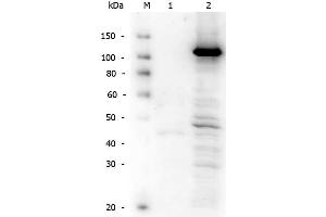 Rabbit anti-hTERT WB Western Blot of Rabbit anti-Telomerase catalytic subunit antibody. (hTERT (C-Term) antibody)