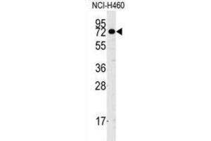 Western Blotting (WB) image for anti-Cancer Susceptibility Candidate 3 (CASC3) antibody (ABIN2995203) (CASC3 antibody)