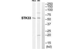 Western blot analysis of extracts from HeLa/293 cells, using STK33 antibody. (STK33 antibody  (N-Term))