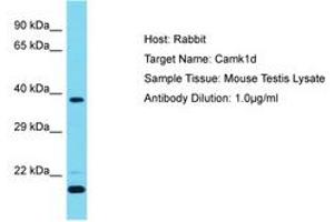 Image no. 1 for anti-Calcium/calmodulin-Dependent Protein Kinase ID (CAMK1D) (AA 39-88) antibody (ABIN6750384) (CAMK1D antibody  (AA 39-88))