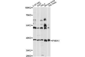 Western blot analysis of extracts of various cell lines, using PNMA1 antibody (ABIN6291181) at 1:3000 dilution. (PNMA1 antibody)