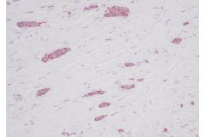 Immunohistochemistry (IHC) image for anti-Chemokine (C-C Motif) Ligand 5 (CCL5) antibody (ABIN2476317) (CCL5 antibody)