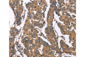 Immunohistochemistry (IHC) image for anti-BCL2/adenovirus E1B 19kDa Interacting Protein 2 (BNIP2) antibody (ABIN2432679) (BNIP2 antibody)