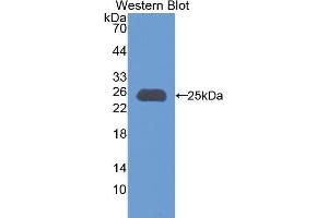 Western Blotting (WB) image for anti-Apolipoprotein M (APOM) (AA 20-190) antibody (ABIN1175647) (Apolipoprotein M antibody  (AA 20-190))