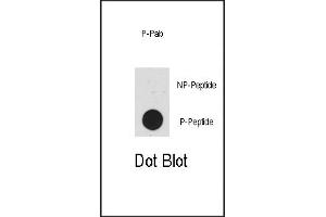 Dot blot analysis of anti-p53-pT55 Pab (R) on nitrocellulose membrane. (p53 antibody  (pThr55))