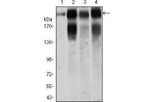 Western Blotting (WB) image for anti-Integrin beta 4 (ITGB4) (AA 1619-1822) antibody (ABIN1724805)