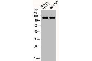 Western Blot analysis of MOUSE-BRAIN SH-SY5Y cells using Phospho-Stat1 (Y701) Polyclonal Antibody (STAT1 antibody  (pTyr701))