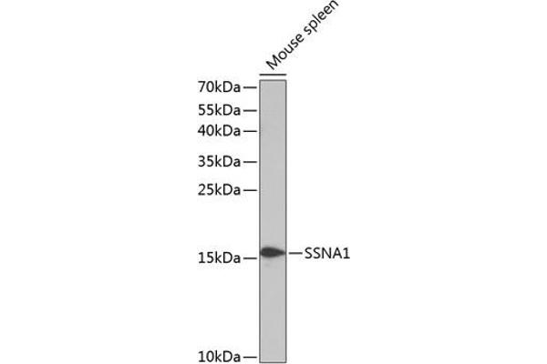 SSNA1 antibody  (AA 1-119)