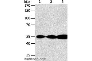 Western blot analysis of Jurkat, Hela and A549 cell, using GSR Polyclonal Antibody at dilution of 1:750 (Glutathione Reductase antibody)