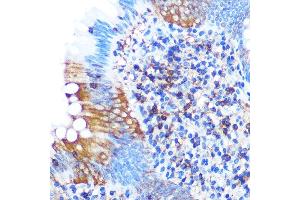 Immunohistochemistry of paraffin-embedded human appendix using PG Rabbit mAb (ABIN1679556, ABIN3018645, ABIN3018646 and ABIN7101637) at dilution of 1:100 (40x lens). (PGAM1 antibody)