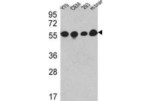 Western Blotting (WB) image for anti-Tubulin, beta (TUBB) antibody (ABIN5014943) (TUBB antibody)